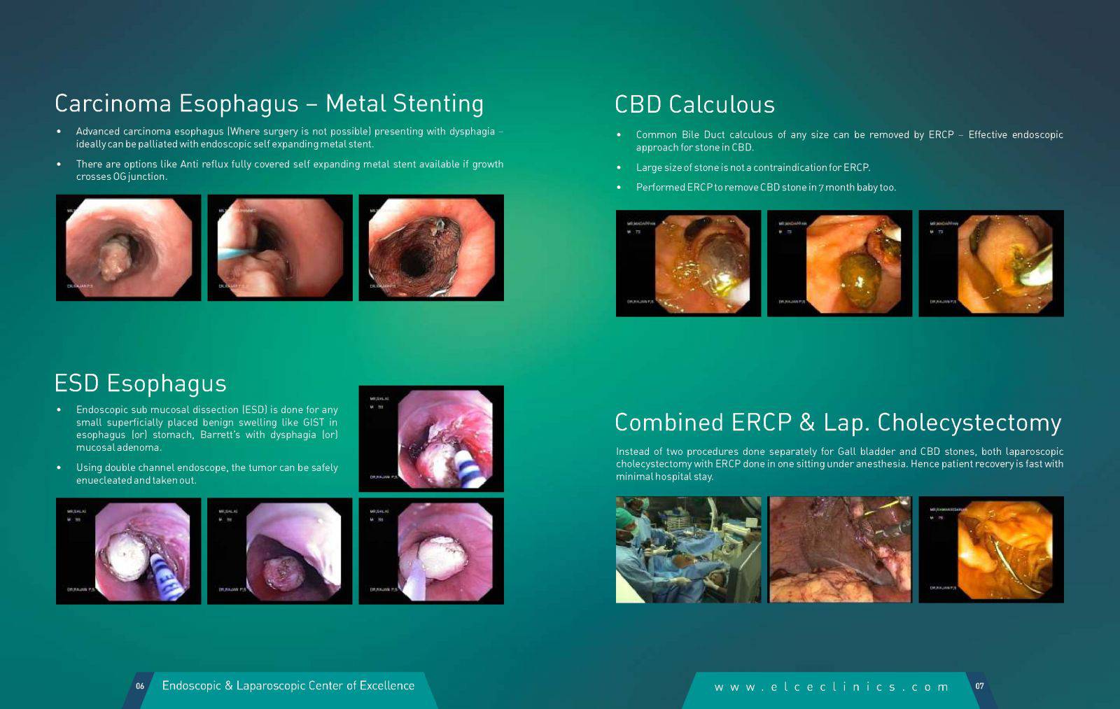 Therapeutic Endoscopy Elce Clinics