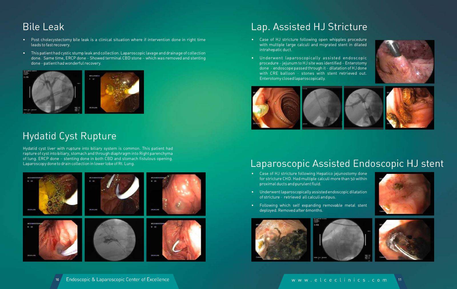 Therapeutic Endoscopy Elce Clinics