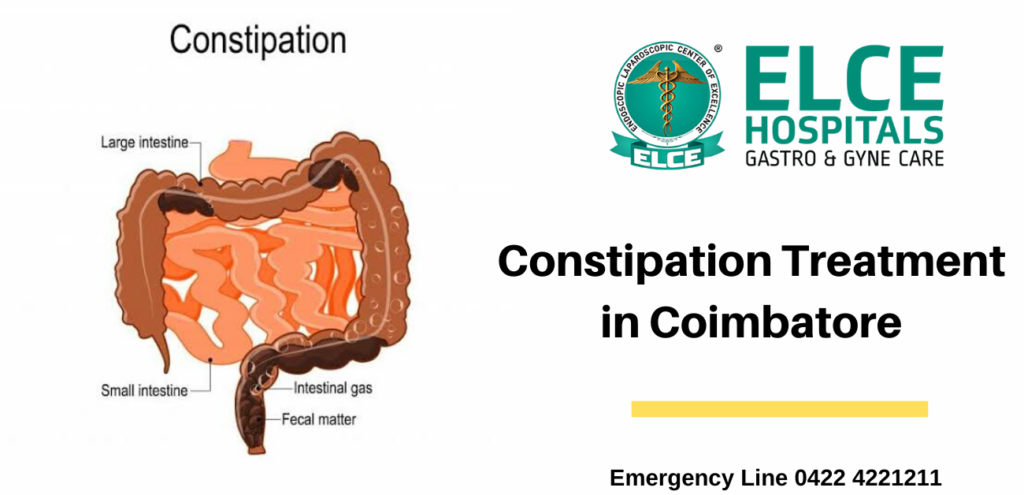 Constipation Treatment in Coimbatore