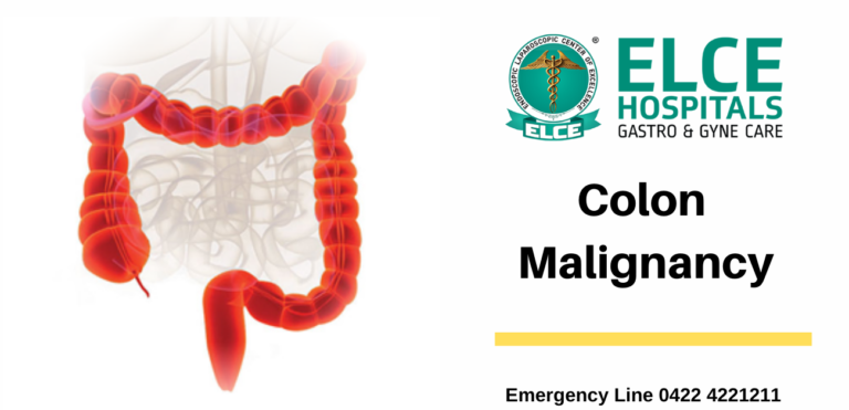 Liver Specialist Hospital in Coimbatore