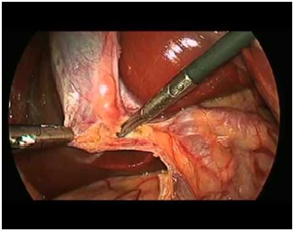 Gastro intestine surgery hospitals in coimbatore