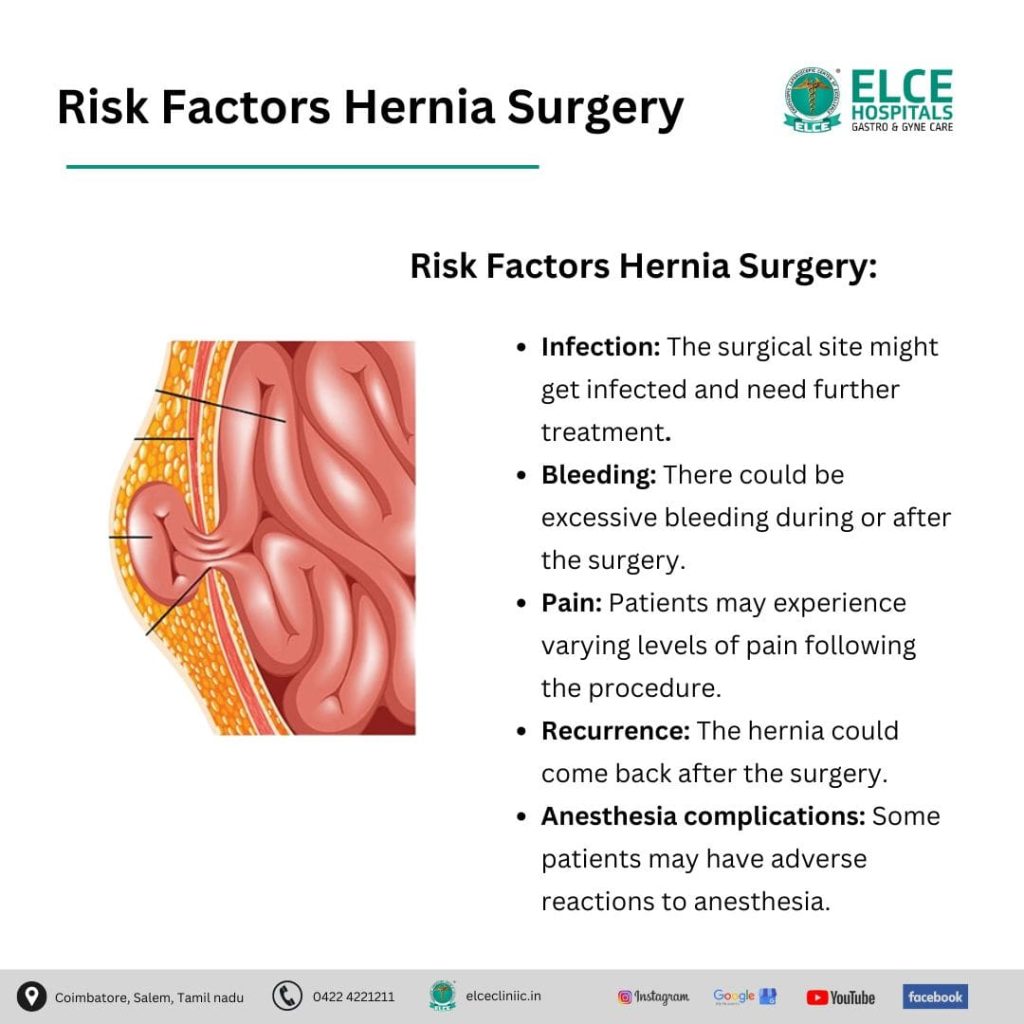 Hernia When To Go Hospital – Hernia In Adults – FPYK