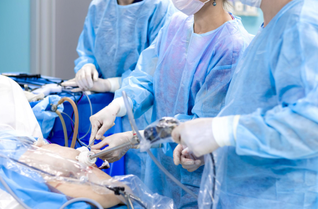 Laparoscopic Hiatal Hernia Repair: A Modern Solution for Long-Term Acid Reflux Relief