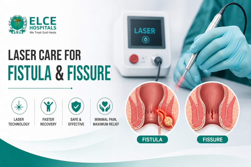 Fistula Laser Treatment and Fissure Laser Treatment – A New, Pain-Free Approach to Long Term Relief