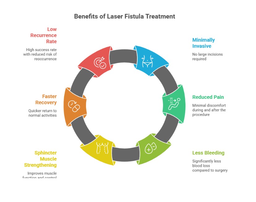 laser treatment for fistula